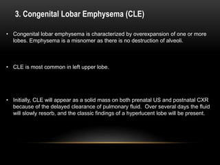 3. Congenital Lobar Emphysema (CLE)
• Congenital lobar emphysema is characterized by overexpansion of one or more
lobes. Emphysema is a misnomer as there is no destruction of alveoli.
• CLE is most common in left upper lobe.
• Initially, CLE will appear as a solid mass on both prenatal US and postnatal CXR
because of the delayed clearance of pulmonary fluid. Over several days the fluid
will slowly resorb, and the classic findings of a hyperlucent lobe will be present.
 