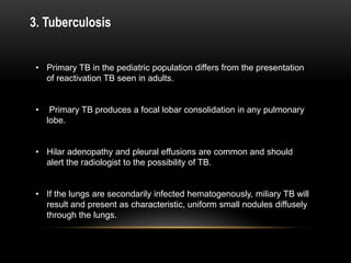 • Primary TB in the pediatric population differs from the presentation
of reactivation TB seen in adults.
• Primary TB produces a focal lobar consolidation in any pulmonary
lobe.
• Hilar adenopathy and pleural effusions are common and should
alert the radiologist to the possibility of TB.
• If the lungs are secondarily infected hematogenously, miliary TB will
result and present as characteristic, uniform small nodules diffusely
through the lungs.
3. Tuberculosis
 