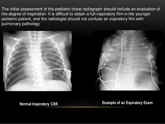 Paediatric chest imaging