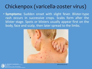 Chickenpox (varicella-zoster virus)
• Symptoms: Sudden onset with slight fever. Blister-type
rash occurs in successive crops. Scabs form after the
blister stage. Spots or blisters usually appear first on the
body, face and scalp, then later spread to the limbs.
www.amcal.com.au
 