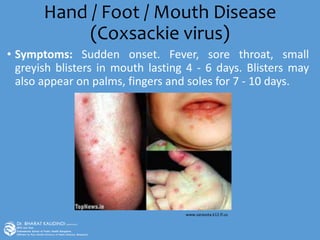 Hand / Foot / Mouth Disease
(Coxsackie virus)
• Symptoms: Sudden onset. Fever, sore throat, small
greyish blisters in mouth lasting 4 - 6 days. Blisters may
also appear on palms, fingers and soles for 7 - 10 days.
www.sarasota.k12.fl.us
 