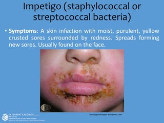 Impetigo (staphylococcal or
streptococcal bacteria)
• Symptoms: A skin infection with moist, purulent, yellow
crusted sores surrounded by redness. Spreads forming
new sores. Usually found on the face.
doctorgrasshopper.wordpress.com
 