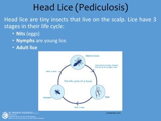 Head Lice (Pediculosis)
Head lice are tiny insects that live on the scalp. Lice have 3
stages in their life cycle:
• Nits (eggs)
• Nymphs are young lice.
• Adult lice
comberskc.com
 