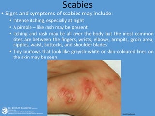 Scabies
• Signs and symptoms of scabies may include:
• Intense itching, especially at night
• A pimple – like rash may be present
• Itching and rash may be all over the body but the most common
sites are between the fingers, wrists, elbows, armpits, groin area,
nipples, waist, buttocks, and shoulder blades.
• Tiny burrows that look like greyish-white or skin-coloured lines on
the skin may be seen.
healthool.com
 