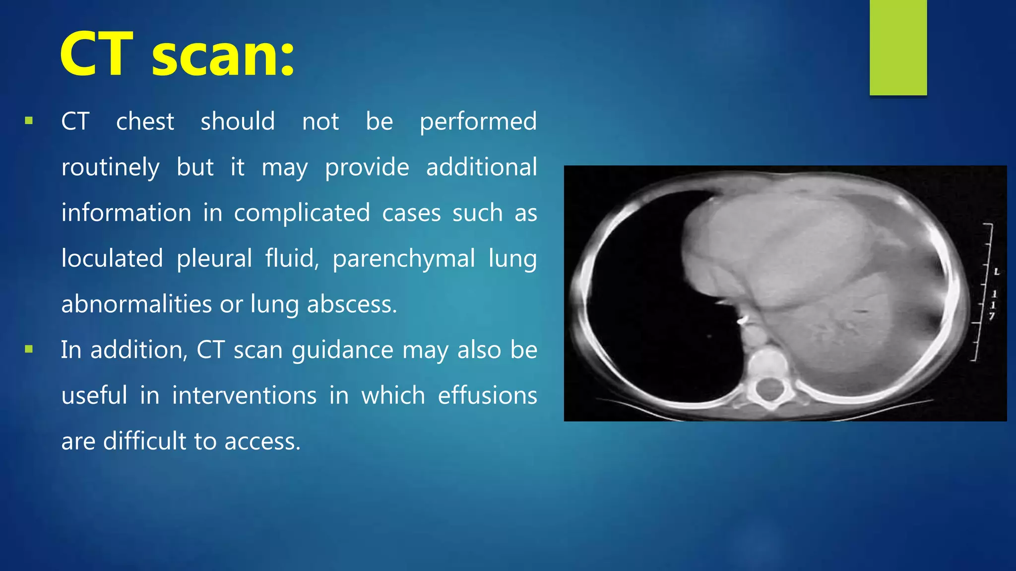 CT scan:
 CT chest should not be performed
routinely but it may provide additional
information in complicated cases such as
loculated pleural fluid, parenchymal lung
abnormalities or lung abscess.
 In addition, CT scan guidance may also be
useful in interventions in which effusions
are difficult to access.
 