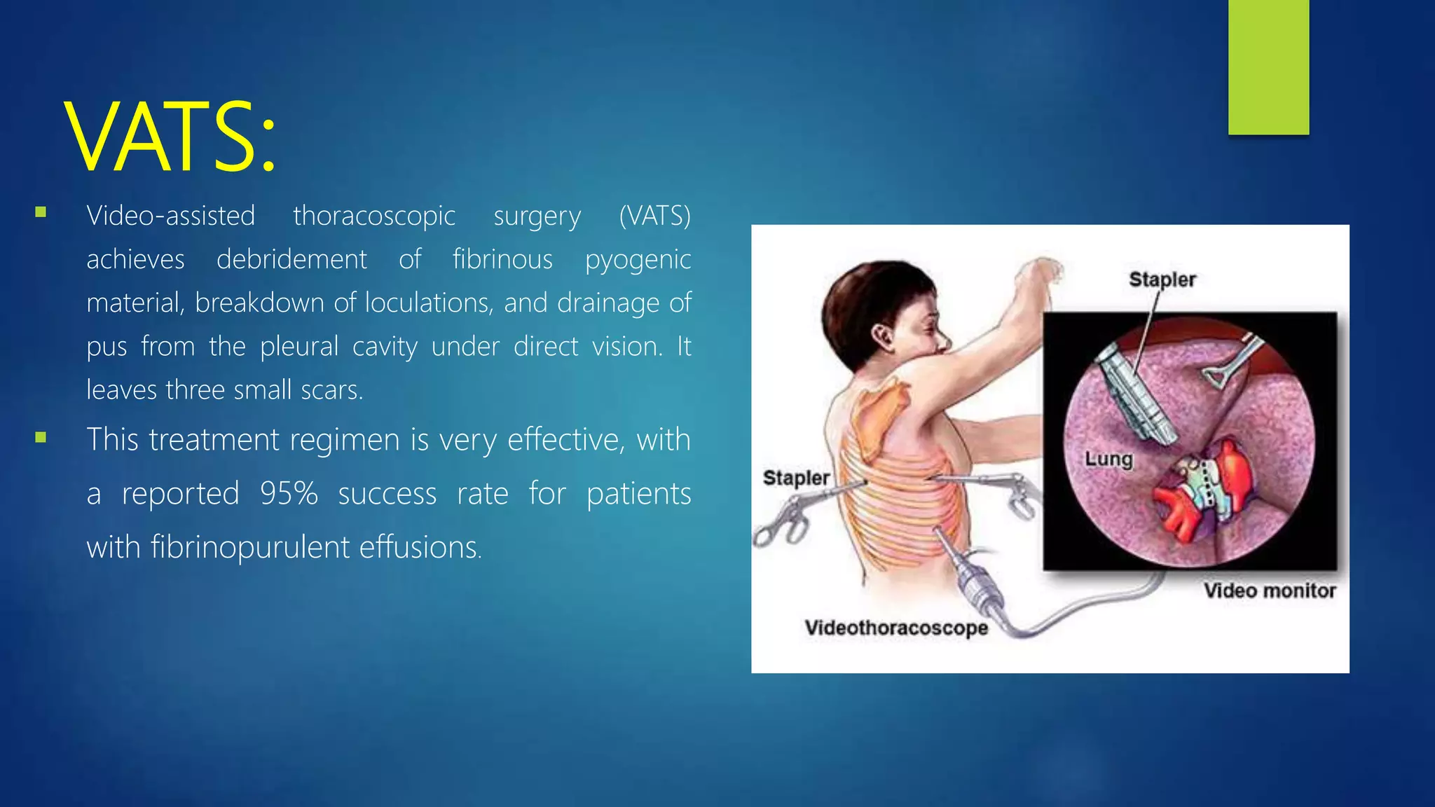 VATS:
 Video-assisted thoracoscopic surgery (VATS)
achieves debridement of fibrinous pyogenic
material, breakdown of loculations, and drainage of
pus from the pleural cavity under direct vision. It
leaves three small scars.
 This treatment regimen is very effective, with
a reported 95% success rate for patients
with fibrinopurulent effusions.
 