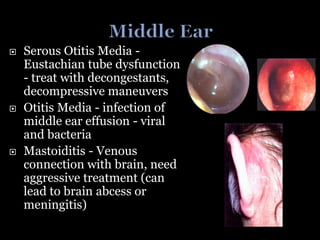  Serous Otitis Media -
Eustachian tube dysfunction
- treat with decongestants,
decompressive maneuvers
 Otitis Media - infection of
middle ear effusion - viral
and bacteria
 Mastoiditis - Venous
connection with brain, need
aggressive treatment (can
lead to brain abcess or
meningitis)
 