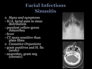  Signs and symptoms
- H/A, facial pain in sinus
distribution
- purulent yellow-green
rhinorrhea
- fever
- CT more sensitive than
plain films
 Causative Organisms
- gram positives and H. flu
(acute)
- anaerobes, gram neg
(chronic)
 