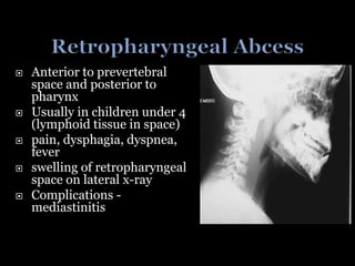  Anterior to prevertebral
space and posterior to
pharynx
 Usually in children under 4
(lymphoid tissue in space)
 pain, dysphagia, dyspnea,
fever
 swelling of retropharyngeal
space on lateral x-ray
 Complications -
mediastinitis
 