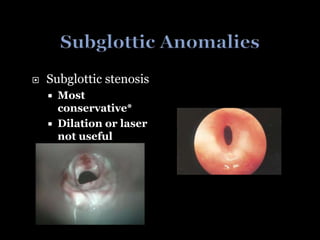  Subglottic stenosis
 Most
conservative*
 Dilation or laser
not useful
 