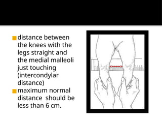 Paediatric Examination 1 orthopaedic test | PPTX