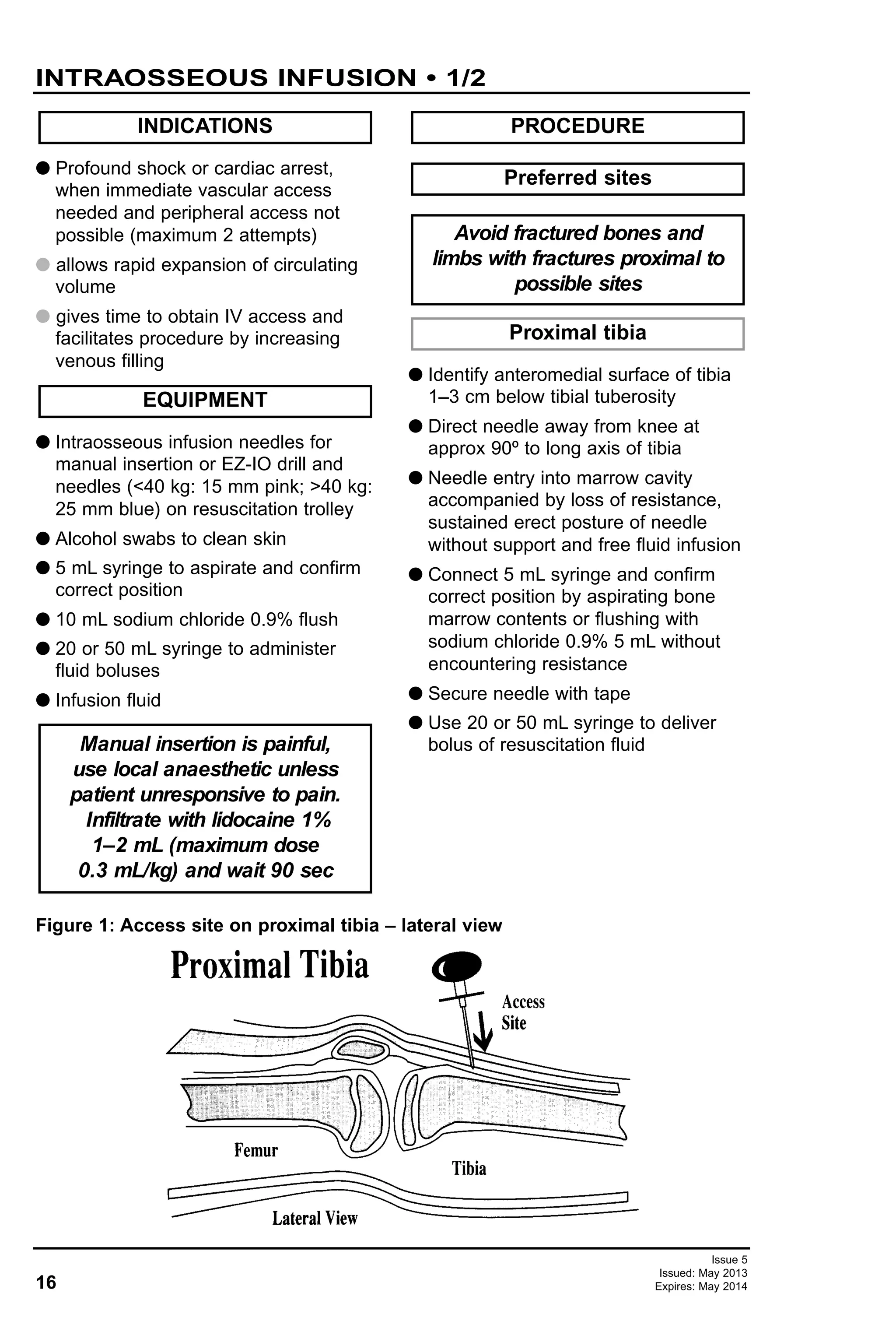 G Profound shock or cardiac arrest,
when immediate vascular access
needed and peripheral access not
possible (maximum 2 attempts)
G allows rapid expansion of circulating
volume
G gives time to obtain IV access and
facilitates procedure by increasing
venous filling
G Intraosseous infusion needles for
manual insertion or EZ-IO drill and
needles (<40 kg: 15 mm pink; >40 kg:
25 mm blue) on resuscitation trolley
G Alcohol swabs to clean skin
G 5 mL syringe to aspirate and confirm
correct position
G 10 mL sodium chloride 0.9% flush
G 20 or 50 mL syringe to administer
fluid boluses
G Infusion fluid
G Identify anteromedial surface of tibia
1–3 cm below tibial tuberosity
G Direct needle away from knee at
approx 90º to long axis of tibia
G Needle entry into marrow cavity
accompanied by loss of resistance,
sustained erect posture of needle
without support and free fluid infusion
G Connect 5 mL syringe and confirm
correct position by aspirating bone
marrow contents or flushing with
sodium chloride 0.9% 5 mL without
encountering resistance
G Secure needle with tape
G Use 20 or 50 mL syringe to deliver
bolus of resuscitation fluid
Proximal tibia
Avoid fractured bones and
limbs with fractures proximal to
possible sites
Preferred sites
PROCEDURE
Manual insertion is painful,
use local anaesthetic unless
patient unresponsive to pain.
Infiltrate with lidocaine 1%
1–2 mL (maximum dose
0.3 mL/kg) and wait 90 sec
EQUIPMENT
INDICATIONS
16
INTRAOSSEOUS INFUSION • 1/2
Issue 5
Issued: May 2013
Expires: May 2014
Figure 1: Access site on proximal tibia – lateral view
 