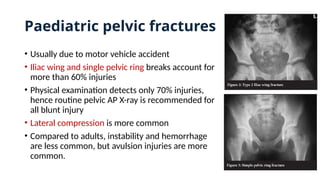 Paediatric pelvic fractures
• Usually due to motor vehicle accident
• Iliac wing and single pelvic ring breaks account for
more than 60% injuries
• Physical examination detects only 70% injuries,
hence routine pelvic AP X-ray is recommended for
all blunt injury
• Lateral compression is more common
• Compared to adults, instability and hemorrhage
are less common, but avulsion injuries are more
common.
 