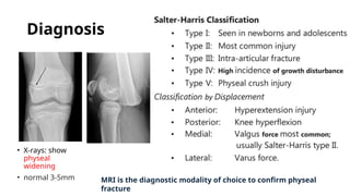 Diagnosis
• X-rays: show
physeal
widening
• normal 3-5mm MRI is the diagnostic modality of choice to confirm physeal
fracture
 