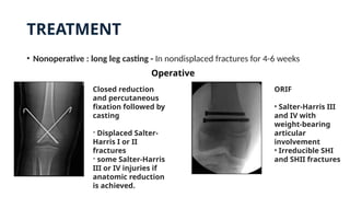 TREATMENT
• Nonoperative : long leg casting - In nondisplaced fractures for 4-6 weeks
Closed reduction
and percutaneous
fixation followed by
casting
- Displaced Salter-
Harris I or II
fractures
- some Salter-Harris
III or IV injuries if
anatomic reduction
is achieved.
ORIF
• Salter-Harris III
and IV with
weight-bearing
articular
involvement
• Irreducible SHI
and SHII fractures
Operative
 