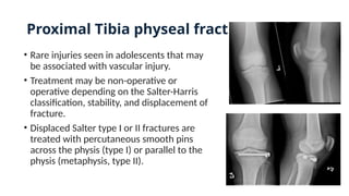 Proximal Tibia physeal fracture
• Rare injuries seen in adolescents that may
be associated with vascular injury.
• Treatment may be non-operative or
operative depending on the Salter-Harris
classification, stability, and displacement of
fracture.
• Displaced Salter type I or II fractures are
treated with percutaneous smooth pins
across the physis (type I) or parallel to the
physis (metaphysis, type II).
 