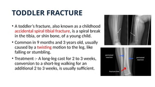 TODDLER FRACTURE
• A toddler’s fracture, also known as a childhood
accidental spiral tibial fracture, is a spiral break
in the tibia, or shin bone, of a young child.
• Common in 9 months and 3 years old, usually
caused by a twisting motion to the leg, like
falling or stumbling.
• Treatment :- A long-leg cast for 2 to 3 weeks,
conversion to a short-leg walking for an
additional 2 to 3 weeks, is usually sufficient.
 