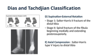 D) Supination-External Rotation
- Stage 1: Salter-Harris II fracture of the
distal tibia
- Stage II: Spiral fracture of the fibula
beginning medially and extending
posterosupeiorly.
E) Axial Compression : Salter-Harris
type V injury to distal tibia
Dias and Tachdjian Classification
 