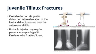 • Closed reduction via gentle
distraction internal rotation of the
foot and direct pressure over the
anterolateral tibia.
• Unstable injuries may require
percutaneous pinning with
Kirschner wire fixation/Screw.
Juvenile Tillaux Fractures
 