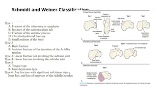 Schmidt and Weiner Classification
 