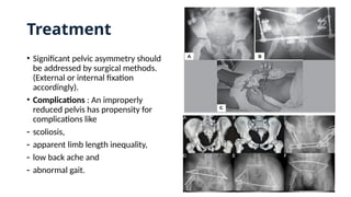 • Significant pelvic asymmetry should
be addressed by surgical methods.
(External or internal fixation
accordingly).
• Complications : An improperly
reduced pelvis has propensity for
complications like
- scoliosis,
- apparent limb length inequality,
- low back ache and
- abnormal gait.
Treatment
 