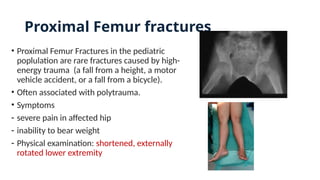 Proximal Femur fractures
• Proximal Femur Fractures in the pediatric
poplulation are rare fractures caused by high-
energy trauma (a fall from a height, a motor
vehicle accident, or a fall from a bicycle).
• Often associated with polytrauma.
• Symptoms
- severe pain in affected hip
- inability to bear weight
- Physical examination: shortened, externally
rotated lower extremity
 