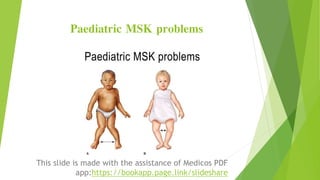 Paediatric MSK problems
This slide is made with the assistance of Medicos PDF
app:https://bookapp.page.link/slideshare
 
