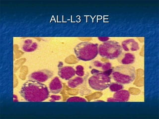 Paediatric oncology | PPT