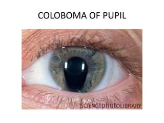 Paediatric ophthalmic disorders | PPTX