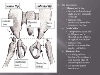 Paediatric Orthopaedic | PPTX