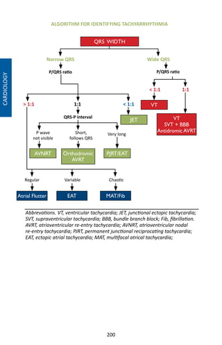 200
ALGORITHM FOR IDENTIFYING TACHYARRHYTHMIA
Abbrevations. VT, ventricular tachycardia; JET, junctional ectopic tachycardia;
SVT, supraventricular tachycardia; BBB, bundle branch block; Fib, fibrillation.
AVRT, atrioventricular re-entry tachycardia; AVNRT, atrioventricular nodal
re-entry tachycardia; PJRT, permanent junctional reciprocating tachycardia;
EAT, ectopic atrial tachycardia; MAT, multifocal atrical tachycardia;
Wide QRS
QRS-P interval
1:1
P wave
not visible
P/QRS ratio P/QRS ratio
 1:1
1:1 1:1  1:1
Narrow QRS
Short,
follows QRS
Very long
Regular Variable Chaotic
QRS WIDTH
VT
VT
SVT + BBB
Antidromic AVRT
JET
Atrial Flutter
AVNRT Orthodromic
AVRT
PJRT/EAT
EAT MAT/Fib
CARDIOLOGY
 