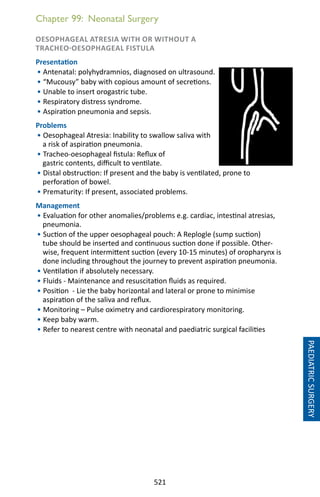 521
Chapter 99: Neonatal Surgery
OESOPHAGEAL ATRESIA WITH OR WITHOUT A
TRACHEO-OESOPHAGEAL FISTULA
Presentation
• Antenatal: polyhydramnios, diagnosed on ultrasound.
• “Mucousy” baby with copious amount of secretions.
• Unable to insert orogastric tube.
• Respiratory distress syndrome.
• Aspiration pneumonia and sepsis.
Problems
• Oesophageal Atresia: Inability to swallow saliva with
a risk of aspiration pneumonia.
• Tracheo-oesophageal fistula: Reflux of
gastric contents, difficult to ventilate.
• Distal obstruction: If present and the baby is ventilated, prone to
perforation of bowel.
• Prematurity: If present, associated problems.
Management
• Evaluation for other anomalies/problems e.g. cardiac, intestinal atresias,
pneumonia.
• Suction of the upper oesophageal pouch: A Replogle (sump suction)
tube should be inserted and continuous suction done if possible. Other-
wise, frequent intermittent suction (every 10-15 minutes) of oropharynx is
done including throughout the journey to prevent aspiration pneumonia.
• Ventilation if absolutely necessary.
• Fluids - Maintenance and resuscitation fluids as required.
• Position - Lie the baby horizontal and lateral or prone to minimise
aspiration of the saliva and reflux.
• Monitoring – Pulse oximetry and cardiorespiratory monitoring.
• Keep baby warm.
• Refer to nearest centre with neonatal and paediatric surgical facilities
PAEDIATRICSURGERY
 