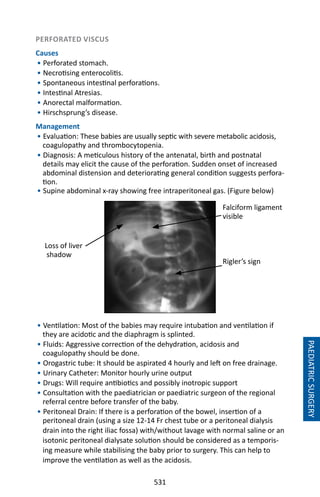531
PERFORATED VISCUS
Causes
• Perforated stomach.
• Necrotising enterocolitis.
• Spontaneous intestinal perforations.
• Intestinal Atresias.
• Anorectal malformation.
• Hirschsprung’s disease.
Management
• Evaluation: These babies are usually septic with severe metabolic acidosis,
coagulopathy and thrombocytopenia.
• Diagnosis: A meticulous history of the antenatal, birth and postnatal
details may elicit the cause of the perforation. Sudden onset of increased
abdominal distension and deteriorating general condition suggests perfora-
tion.
• Supine abdominal x-ray showing free intraperitoneal gas. (Figure below)
• Ventilation: Most of the babies may require intubation and ventilation if
they are acidotic and the diaphragm is splinted.
• Fluids: Aggressive correction of the dehydration, acidosis and
coagulopathy should be done.
• Orogastric tube: It should be aspirated 4 hourly and left on free drainage.
• Urinary Catheter: Monitor hourly urine output
• Drugs: Will require antibiotics and possibly inotropic support
• Consultation with the paediatrician or paediatric surgeon of the regional
referral centre before transfer of the baby.
• Peritoneal Drain: If there is a perforation of the bowel, insertion of a
peritoneal drain (using a size 12-14 Fr chest tube or a peritoneal dialysis
drain into the right iliac fossa) with/without lavage with normal saline or an
isotonic peritoneal dialysate solution should be considered as a temporis-
ing measure while stabilising the baby prior to surgery. This can help to
improve the ventilation as well as the acidosis.
Loss of liver
shadow
Falciform ligament
visible
Rigler’s sign
PAEDIATRICSURGERY
 