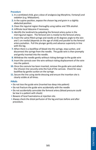 585
Procedure
1. In a ventilated child, give a dose of analgesia (eg Morphine, Fentanyl) and
sedation (e.g. Midazolam).
2. In the supine position, expose the chosen leg and groin in a slightly
abducted position.
3. Clean the inguinal region thoroughly using iodine and 70% alcohol.
4. Infiltrate local lidocaine if necessary.
5. Identify the landmark by palpating the femoral artery pulse in the
mid-inguinal region. The femoral vein is medial to the femoral artery.
6. Insert the saline filled syringe and needle at 45 degrees angle to the skin
and 1 cm medial (depends on the age of child) and parallel to the femoral
artery pulsation. Pull the plunger gently and advance superiorly in-line
with the leg.
7. When there is a backflow of blood into the syringe, stop suction, and
disconnect the syringe from the needle. The guide wire is then promptly
and gently inserted into the needle.
8. Withdraw the needle gently without risking damage to the guide wire
9. Insert the cannula over the wire without risking displacement of the wire
into the patient.
10. Once the cannula has been inserted, remove the guide wire and attach
the infusion line securely onto the hub of the cannula. Check for easy
backflow by gentle suction on the syringe.
11. Secure the line using sterile dressing and ensure the insertion site is
clearly visible at all times.
Pitfalls
• Do not lose the guide wire (inserted too deep into patient)
• Do not fracture the guide wire accidentally with the needle
• Do not accidentally cannulate the femoral artery (blood pressure could
be low in a patient with shock)
• Beware of local haematoma at injection site.
• Always check the distal perfusion of the leg and toes before and after
procedure.
PROCEDURES
 