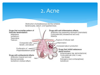 2. Acne
 