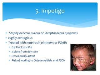  Staphylococcus aureus or Streptococcus pyogenes
 Highly contagious
 Treated with mupirocin ointment or POABs
 E.g Flucloxacillin
 Isolate from day care
 Occasionally admit
 Risk of leading to Osteomyeltisis and PSGN
5. Impetigo
 