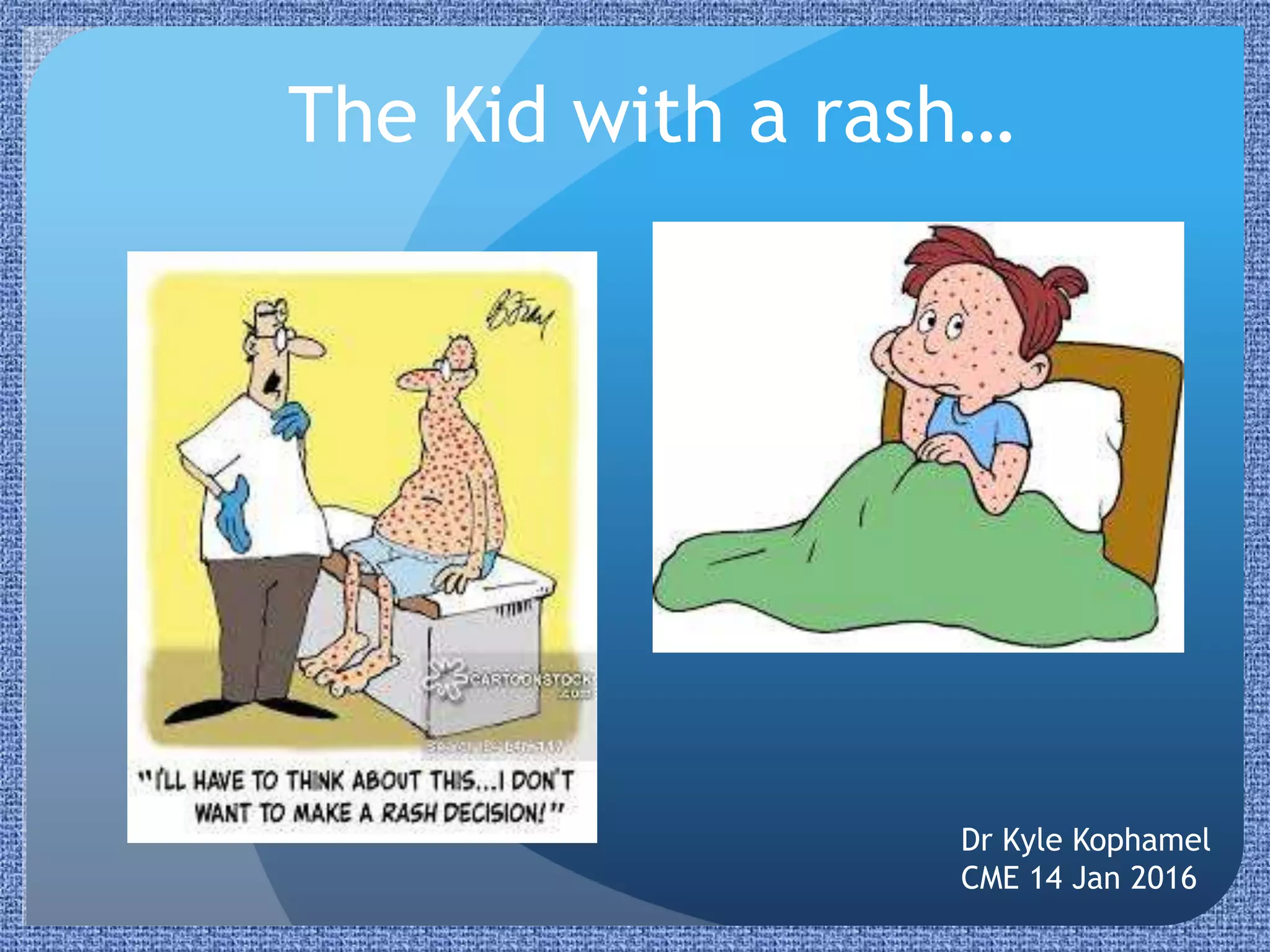 Paediatric Rashes | PPTX