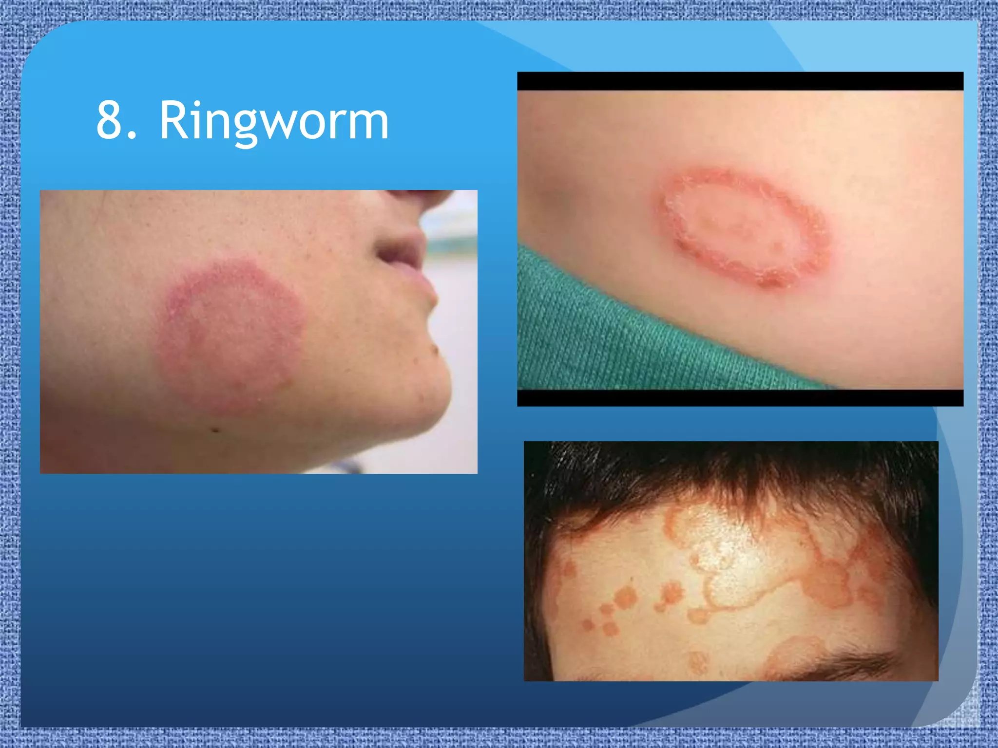 Paediatric Rashes | PPTX