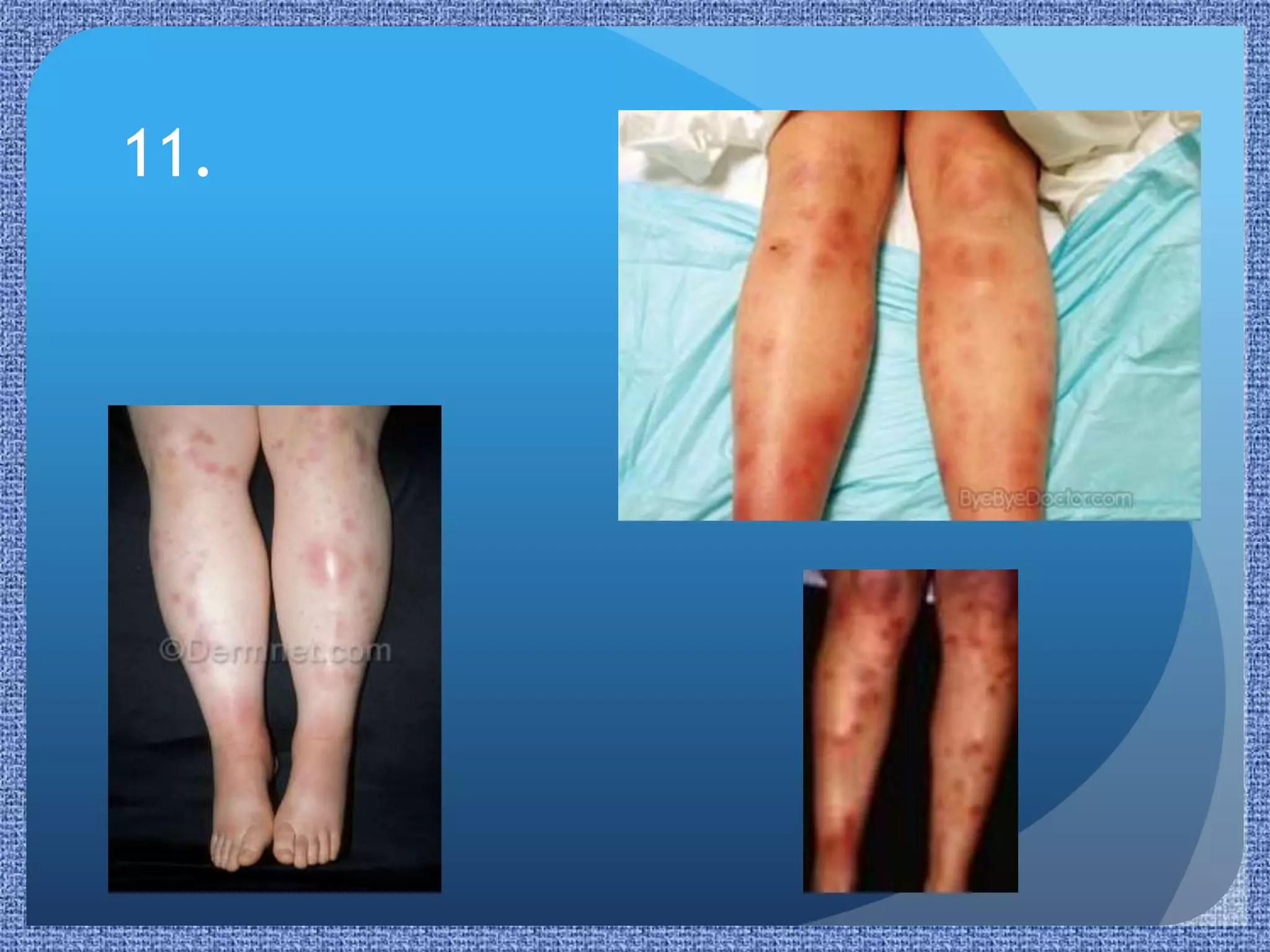 Paediatric Rashes | PPTX