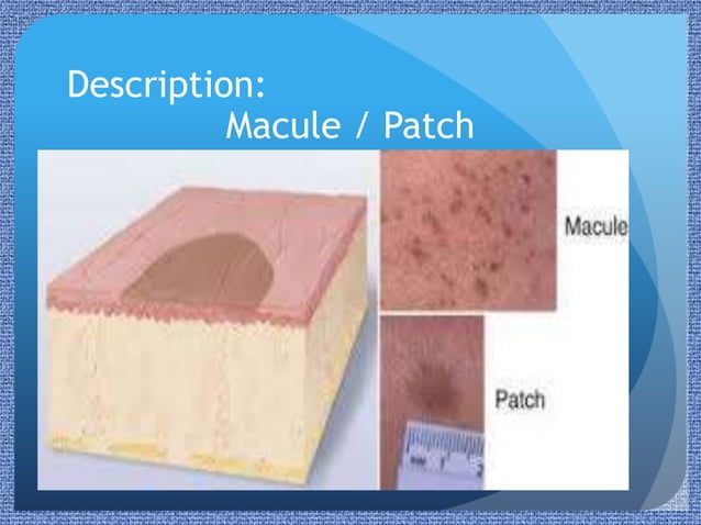 Paediatric Rashes | PPTX | Infectious Diseases | Diseases and Conditions