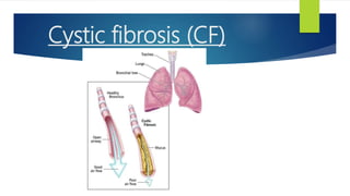 Cystic fibrosis (CF)
 