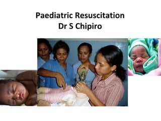 Paediatric Resuscitation
Dr S Chipiro
 