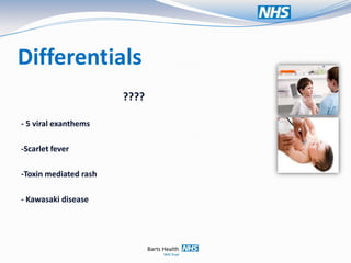 Differentials
                       ????

- 5 viral exanthems

-Scarlet fever

-Toxin mediated rash

- Kawasaki disease
 