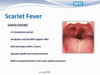Scarlet Fever
CLINICAL FEATURES

- 2-4 incubation period


- Headache and tonsillitis appear after


- Rash develops within 2 hours


- Spreads rapidly over trunk and neck


- With increased density in the neck, axillae and groins.
 