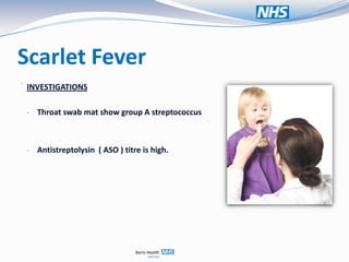 Scarlet Fever
.
    INVESTIGATIONS

    - Throat swab mat show group A streptococcus



    - Antistreptolysin ( ASO ) titre is high.
 