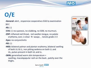 O/E
-General: alert , responsive cooperative child to examination
38 C
-RS: (-)
-CVS: (-) no cyanosis, no clubbing, no SOB, no murmurs.
-ENT: inflamed red throat, red swollen tongue, no palate
   erythema, ears: L=clear R= waspy , tonsils grade 2-3
-Eyes: no conjunctivitis
-NS: (-)
-MSS: bilateral palmar and plantar erythema, bilateral swelling
   of both UL & LL, non pitting oedema on both LL and
   UL, pulses present in both UL and LL.
-SKIN: generalised warm skin temperature +
   swelling, maculopapular rash on the back , patchy over the
   thighs.
 