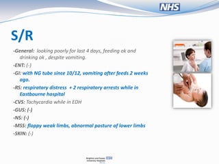 S/R
-General: looking poorly for last 4 days, feeding ok and
   drinking ok , despite vomiting.
-ENT: (-)
-GI: with NG tube since 10/12, vomiting after feeds 2 weeks
   ago.
-RS: respiratory distress + 2 respiratory arrests while in
   Eastbourne hospital
-CVS: Tachycardia while in EDH
-GUS: (-)
-NS: (-)
-MSS: floppy weak limbs, abnormal posture of lower limbs
-SKIN: (-)
 