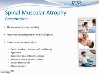 Spinal Muscular Atrophy
 Presentation
 Muscle weakness and wasting


 Preserved mental function and intelligence


 Lower motor neurone signs:

    Flaccid weakness (muscles soft and floppy)
    Hypotonia
    Reduced or absent tendon reflexes
    Normal or absent plantar reflexes
    Muscle fasciculation
    Muscle atrophy
 