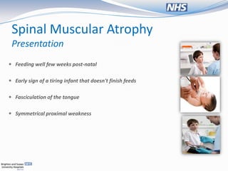 Spinal Muscular Atrophy
 Presentation
 Feeding well few weeks post-natal


 Early sign of a tiring infant that doesn't finish feeds


 Fasciculation of the tongue


 Symmetrical proximal weakness
 