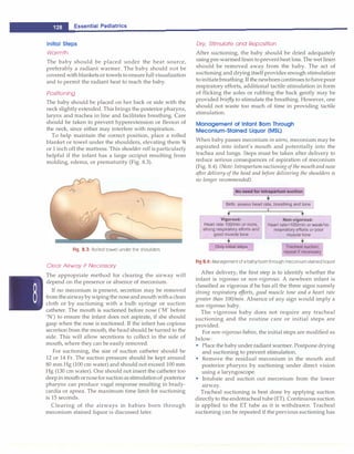 __E_s_
s_
e_
n_t_
i a_
l_
P_
e_
d_i _
a _
tr-ic_
s
_________________________________
Ini ti alSteps
Warmth
The baby should be placed under the heat source,
preferably a radiant warmer. The baby should not be
covered with blanketsortowels to ensurefull visualization
and to permit the radiant heat to reach the baby.
Positioning
The baby should be placed on her back or side with the
neck slightly extended. This brings the posterior pharynx,
larynx and trachea in line and facilitates breathing. Care
should be taken to prevent hyperextension or flexion of
the neck, since either may interfere with respiration.
To help maintain the correct position, place a rolled
blanket or towel under the shoulders, elevating them %
or 1 inch off the mattress. This shoulder roll is particularly
helpful if the infant has a large occiput resulting from
molding, edema, or prematurity (Fig. 8.3).
5--
Fig. 8.3: Rolled towel under the shoulders
Clear Airway if Necessary
The appropriate method for clearing the airway will
depend on the presence or absence of meconium.
If no meconium is present, secretion may be removed
fromtheairwaybywipingthe noseandmouthwithaclean
cloth or by suctioning with a bulb syringe or suction
catheter. The mouth is suctioned before nose ('M' before
'N') to ensure the infant does not aspirate, if she should
gasp when the nose is suctioned. If the infant has copious
secretion from the mouth, the head should be turned to the
side. This will allow secretions to collect in the side of
mouth, where they can be easily removed.
For suctioning, the size of suction catheter should be
12 or 14 Fr. The suction pressure should be kept around
80 mm Hg (100 cm water) and should not exceed 100 mm
Hg (130 cm water). One should not insert the catheter too
deepin mouth ornoseforsuctionasstimulationof posterior
pharynx can produce vagal response resulting in brady­
cardia or apnea. The maximum time limit for suctioning
is 15 seconds.
Clearing of the airways in babies born through
meconium stained liquor is discussed later.
Dry, Stimulate and Reposition
After suctioning, the baby should be dried adequately
usingpre-warmedlinentopreventheat loss. The wet linen
should be removed away from the baby. The act of
suctioning and drying itself provides enough stimulation
toinitiatebreathing.If the newborncontinuestohavepoor
respiratory efforts, additional tactile stimulation in form
of flicking the soles or rubbing the back gently may be
provided briefly to stimulate the breathing. However, one
should not waste too much of time in providing tactile
stimulation.
Management o f Infant Born Through
Meconium-Sta ined Liquor (MSL)
When baby passes meconium in utero, meconium may be
aspirated into infant's mouth and potentially into the
trachea and lungs. Steps must be taken after delivery to
reduce serious consequences of aspiration of meconium
(Fig. 8.4). (Note: Intrapartum suctioning of the mouth and nose
after delivery of the head and before delivering the shoulders is
no longer recommended).
No need for lntrapartum suction
Birth: assess heart rate, breathing and tone
�
Vigorous:
Heart rate 100/min or more,
strong respiratory efforts and
good muscle tone
Only initial steps
Non-vigorous:
Heart rate<100/min or weak/no
respiratory efforts or poor
muscle tone
Tracheal suction;
repeat if necessary
Fig 8.4: Management of a babyborn through meconium stained liquor
After delivery, the first step is to identify whether the
infant is vigorous or non-vigorous. A newborn infant is
classified as vigorous if he has all the three signs namely
strong respiratory efforts, good muscle tone and a heart rate
greater than 100/min. Absence of any sign would imply a
non-vigorous baby.
The vigorous baby does not require any tracheal
suctioning and the routine care or initial steps are
provided.
For non-vigorous babies, the initial steps are modified as
below:
• Place the baby under radiant warmer. Postpone drying
and suctioning to prevent stimulation.
• Remove the residual meconium in the mouth and
posterior pharynx by suctioning under direct vision
using a laryngoscope.
• Intubate and suction out meconium from the lower
airway.
Tracheal suctioning is best done by applying suction
directlyto the endotracheal tube (ET). Continuous suction
is applied to the ET tube as it is withdrawn. Tracheal
suctioning can be repeated if the previous suctioning has
 